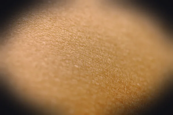 a close up view of a person's skin