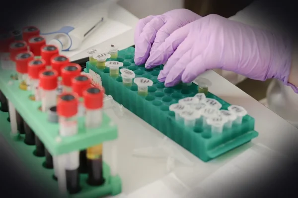laboratory, medical, medicine, hand, research, lab, test, doctor, equipment, scientist, woman, chemistry, science, hospi