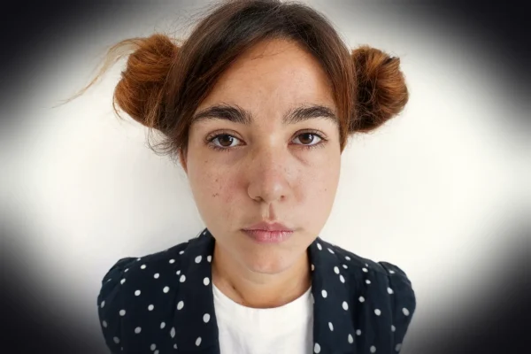 ai generated, teenage acne, skin care, woman, acne treatment, skin problems, facial care, acne breakouts, skin care rout