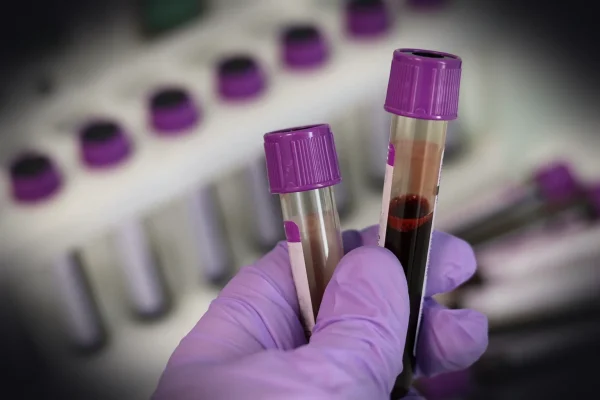 laboratory, medical, medicine, hand, research, lab, test, doctor, equipment, scientist, woman, chemistry, science, hospi