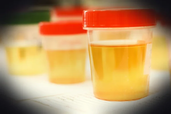 laboratory, medical, medicine, hand, research, lab, test, doctor, equipment, scientist, woman, chemistry, science, hospi