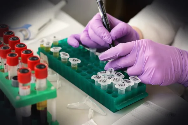 laboratory, medical, medicine, hand, research, lab, test, doctor, equipment, scientist, woman, chemistry, science, hospi