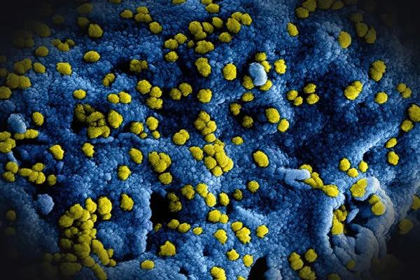 a blue and yellow substance with yellow dots