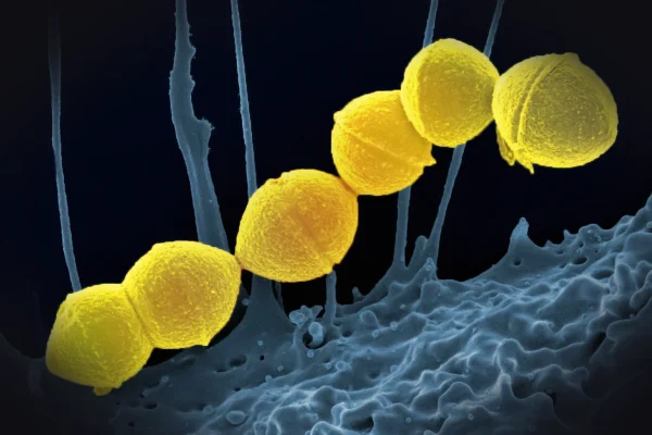 a group of yellow balls sitting on top of a blue substance