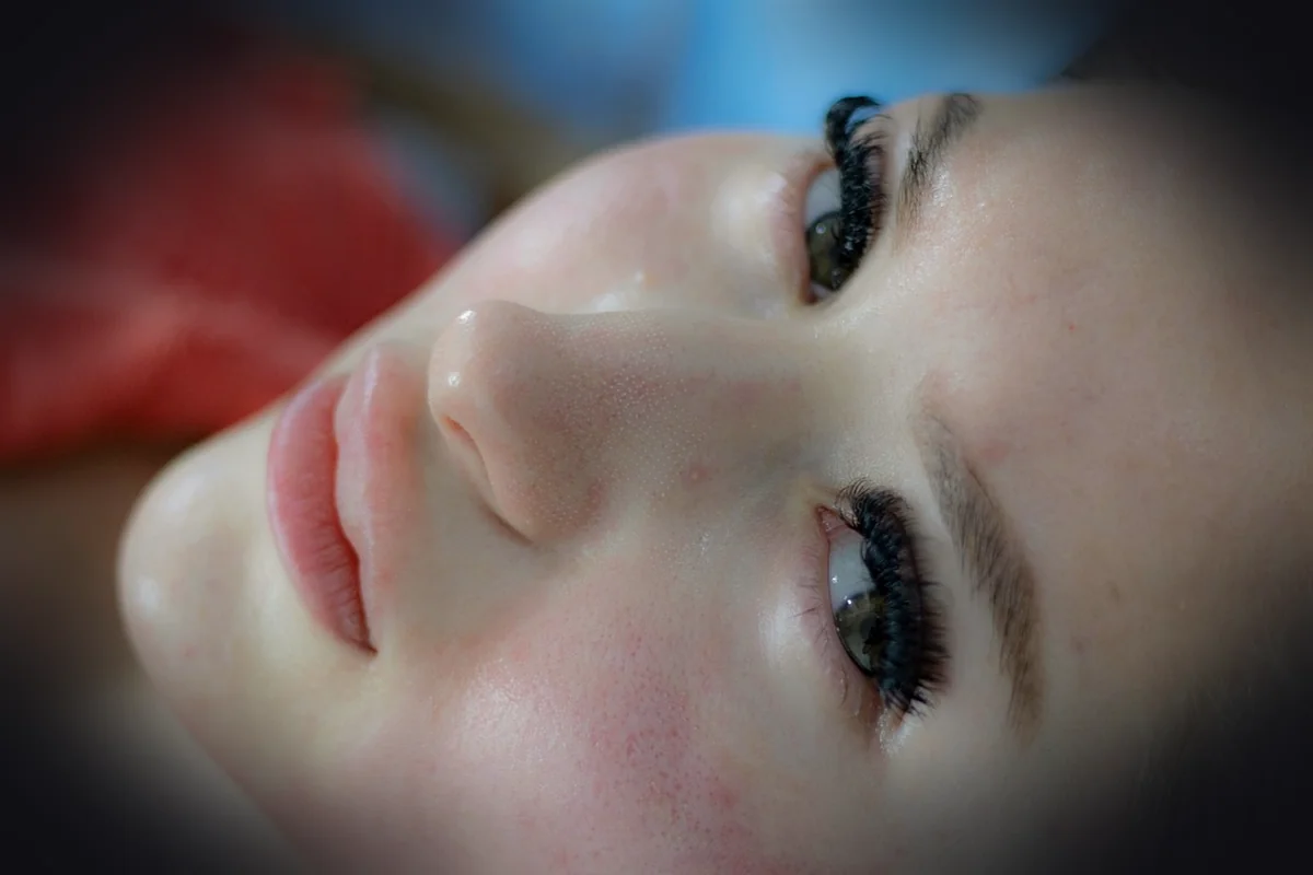 woman, skincare, facial treatment, dermatology, acne scars, skincare, skincare, facial treatment, dermatology, dermatology, d