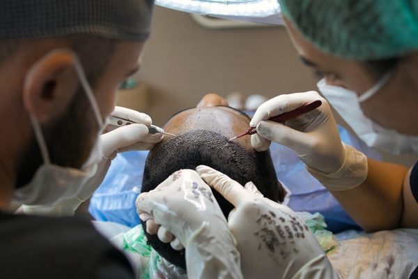 folliculitis decalvans vs androgenetic alopecia